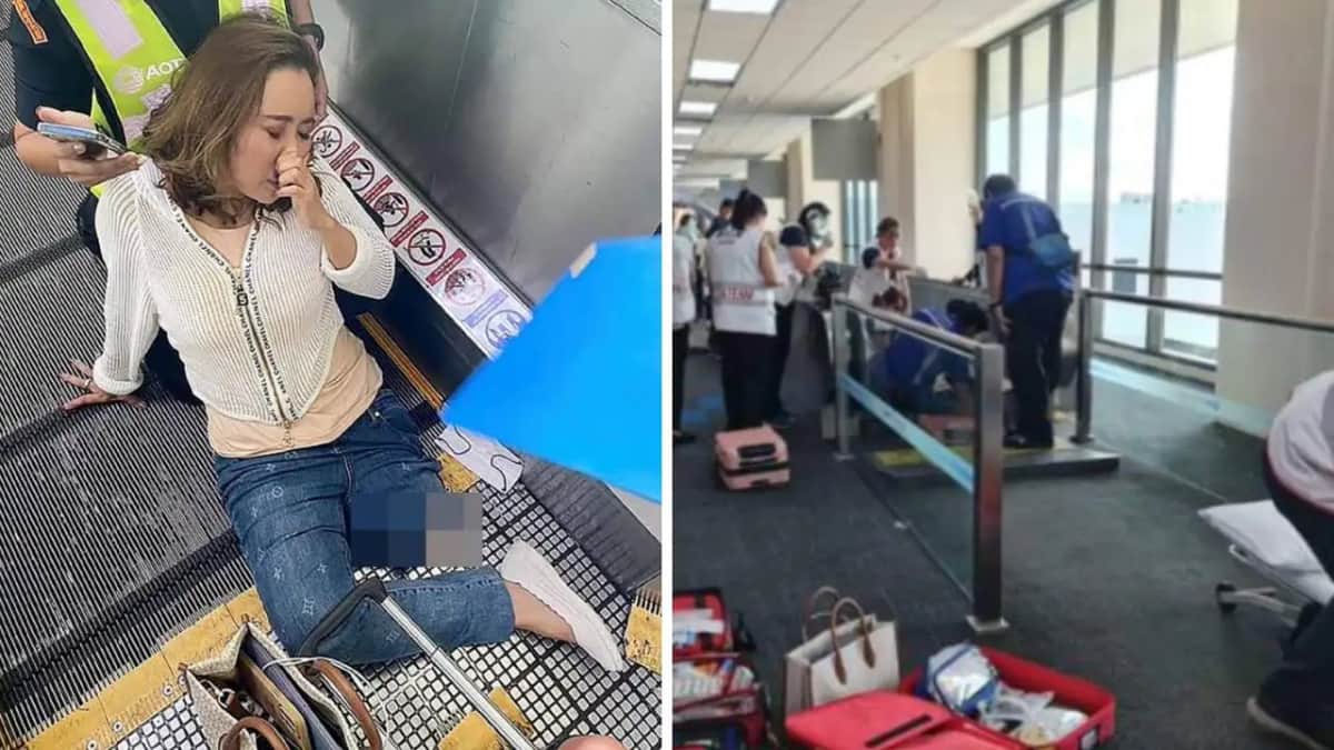 Mujer pierde una pierna tras quedar atrapada en banda transportadora de aeropuerto