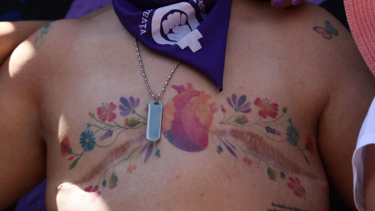 Gobierno canceló Normas Oficiales sobre cáncer de mama, cérvico uterino y lactancia materna