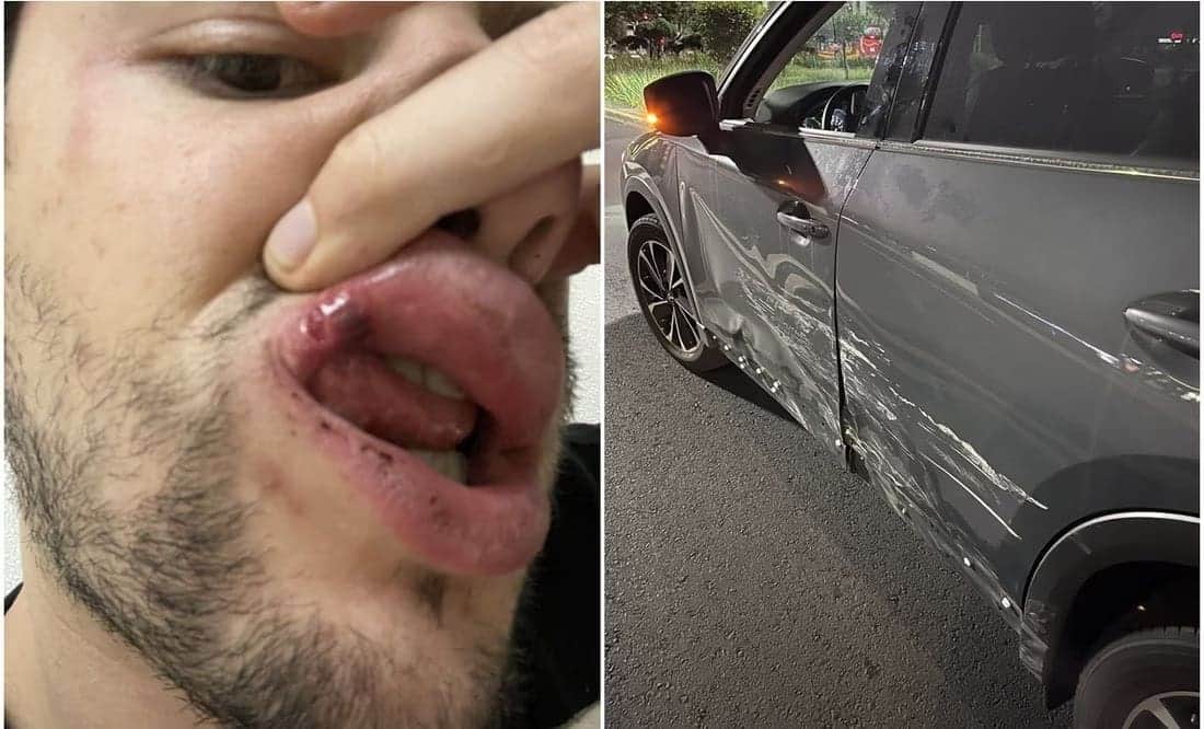VIDEO: El comentarista deportivo Alex Déleon denuncia a policías de CDMX por presunta agresión tras choque en Avenida Universidad