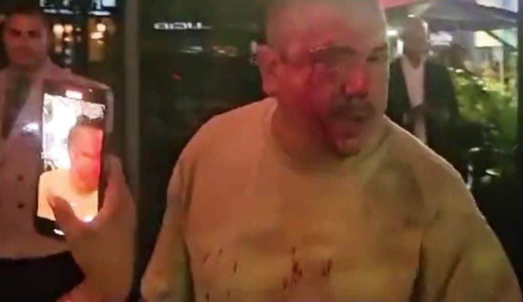 Video: Lo golpean por intentar tomar fotos a Lionel Messi; solo buscaba retratar a su hija en su cumpleaños