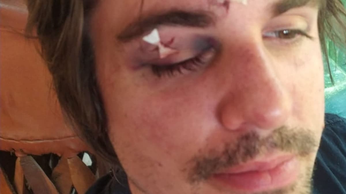 Indigna robo con violencia a médico extranjero residente en Holbox