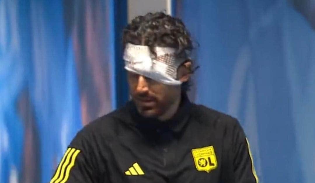 Violencia en futbol francés; fans del Marsella apedrean autobús del Lyon, técnico fue herido