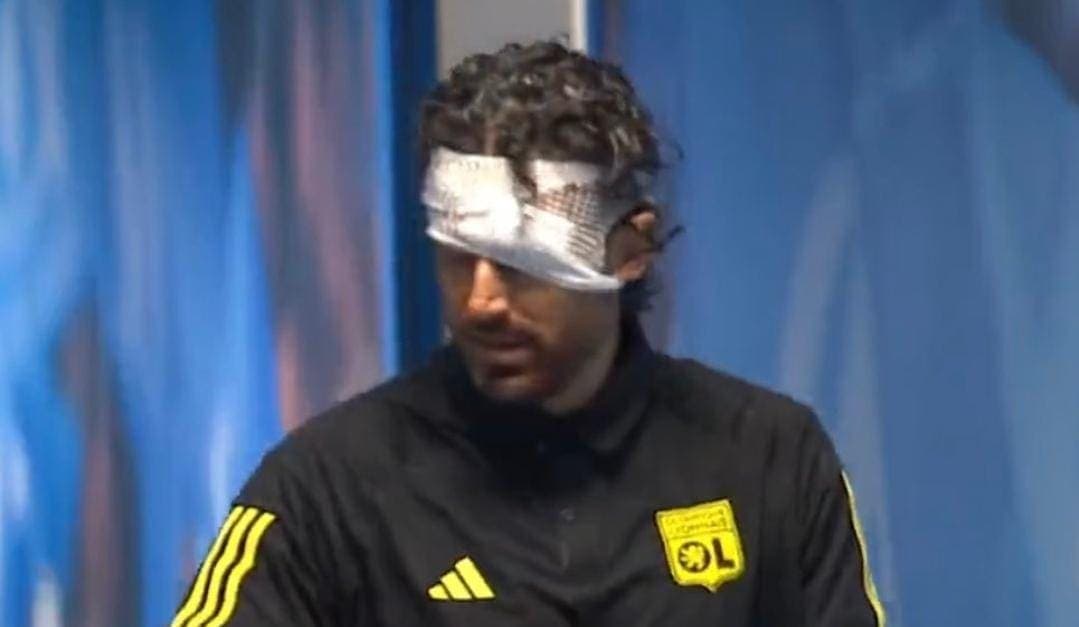 Violencia en futbol francés; fans del Marsella apedrean autobús del Lyon, técnico fue herido