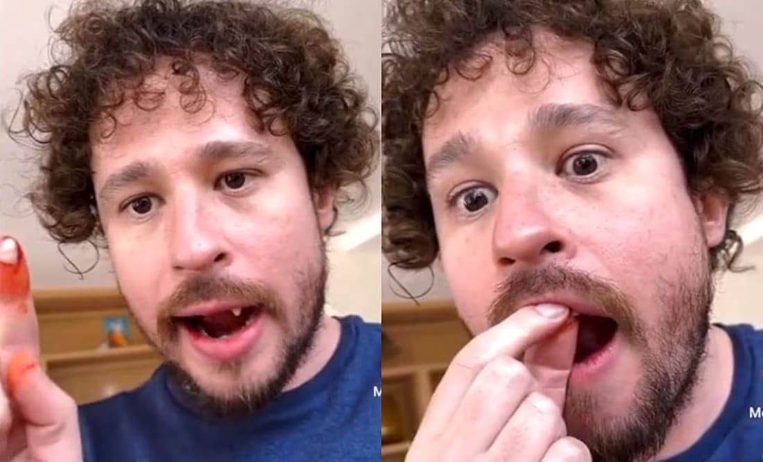 Video: Luisito Comunica "se quita" dos dientes en vivo y preocupa a fans