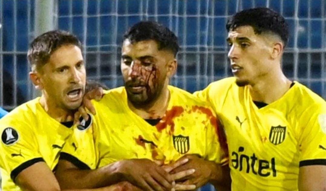 Video: Fanáticos de Rosario Central arrojaron una piedra a futbolista de Peñarol en Copa Libertadores
