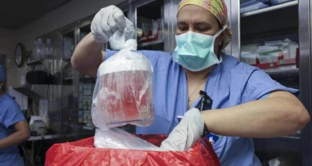 Muere la primera persona que recibió un riñón de cerdo modificado genéticamente