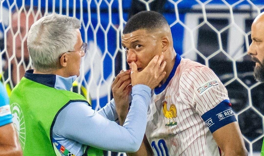 Futbolista Kylian Mbappé se fractura la nariz en la Eurocopa; no sería operado de momento