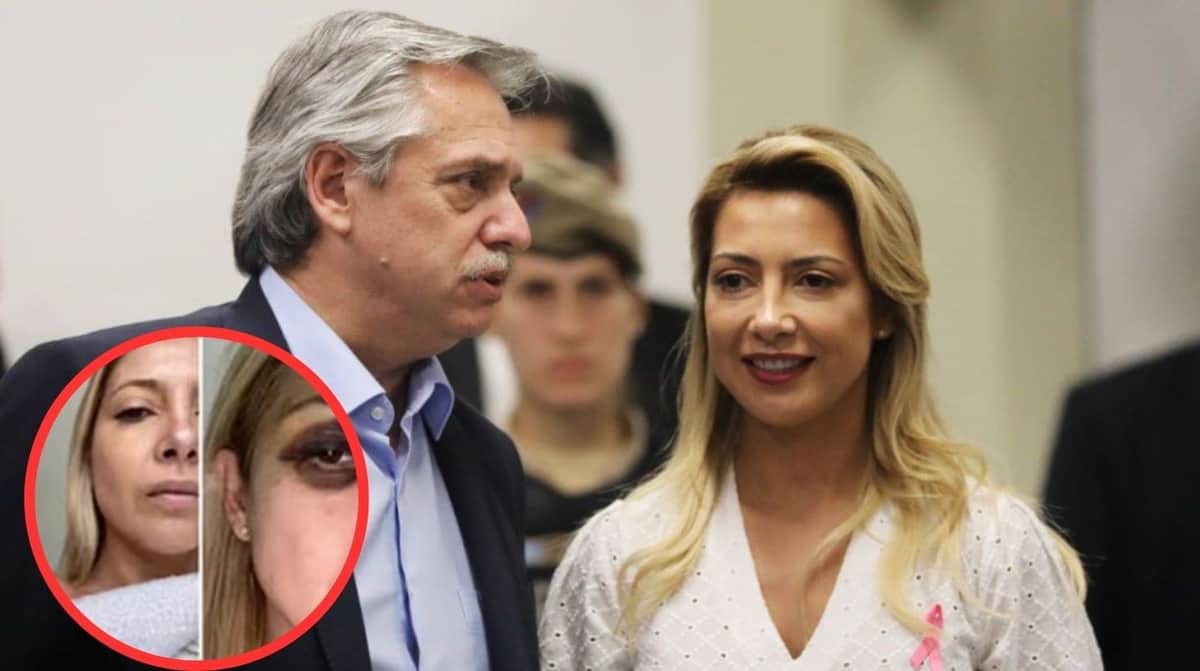 Denuncia exesposa a Alberto Fernández, expresidente de Argentina, por presunta violencia física