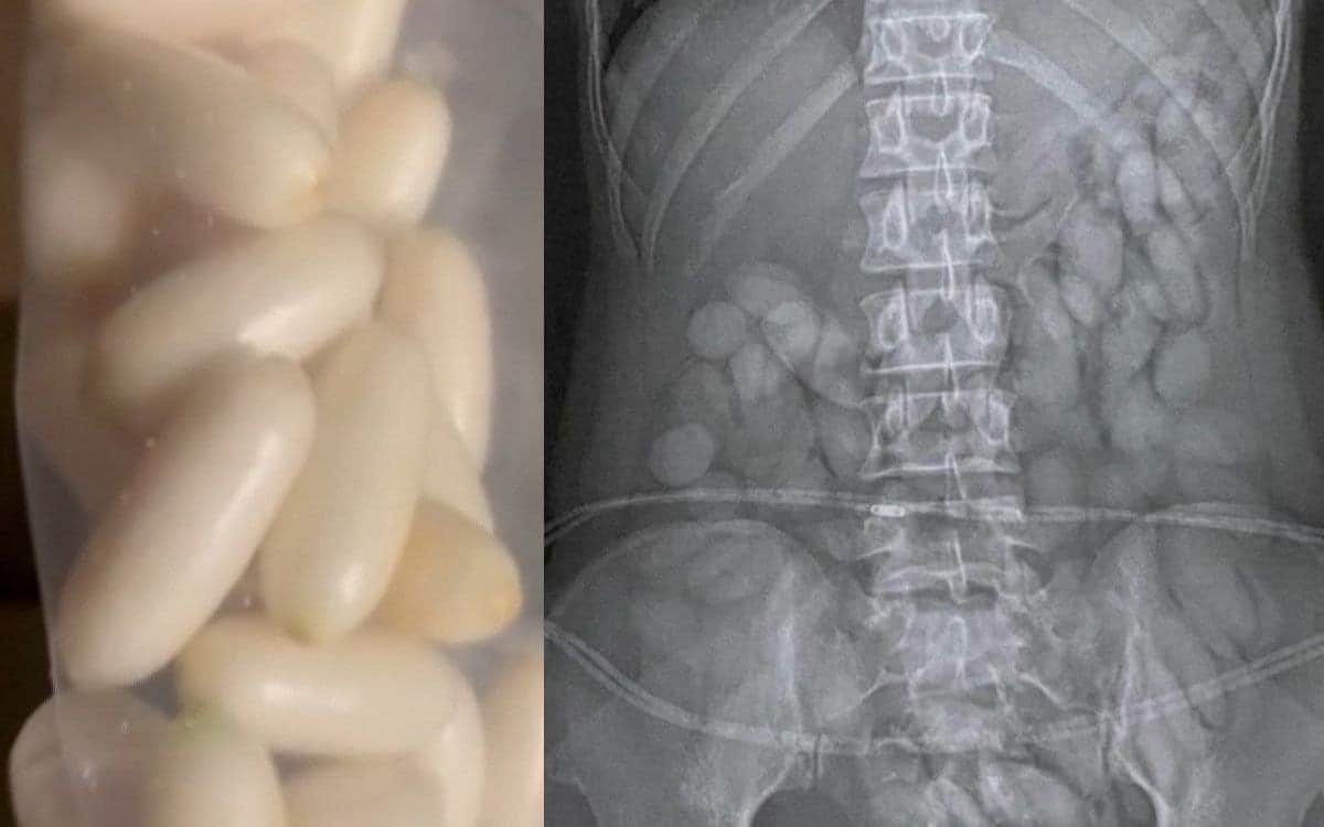 Video: Detienen a mujer con 63 'balas' de cocaína en su organismo en Sudáfrica