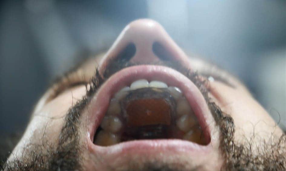 Video: Presentan Mouthpad, el dispositivo que permite controlar tu teléfono con la lengua