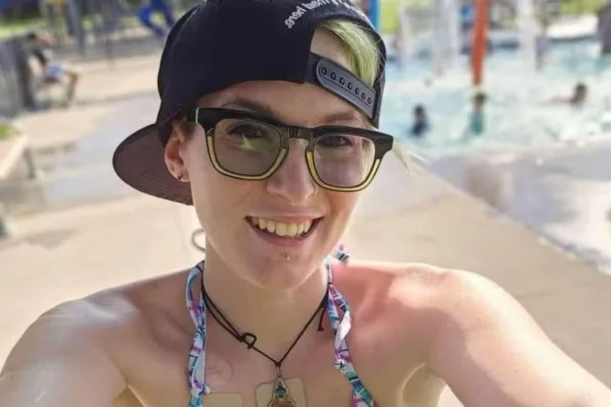 Mujer sufre la “enfermedad de los vampiros”; no puede comer ajo y vomita 30 veces al día