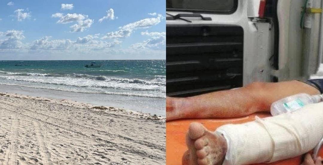 Pescador fue atacado por un tiburón en una playa de Tulum
