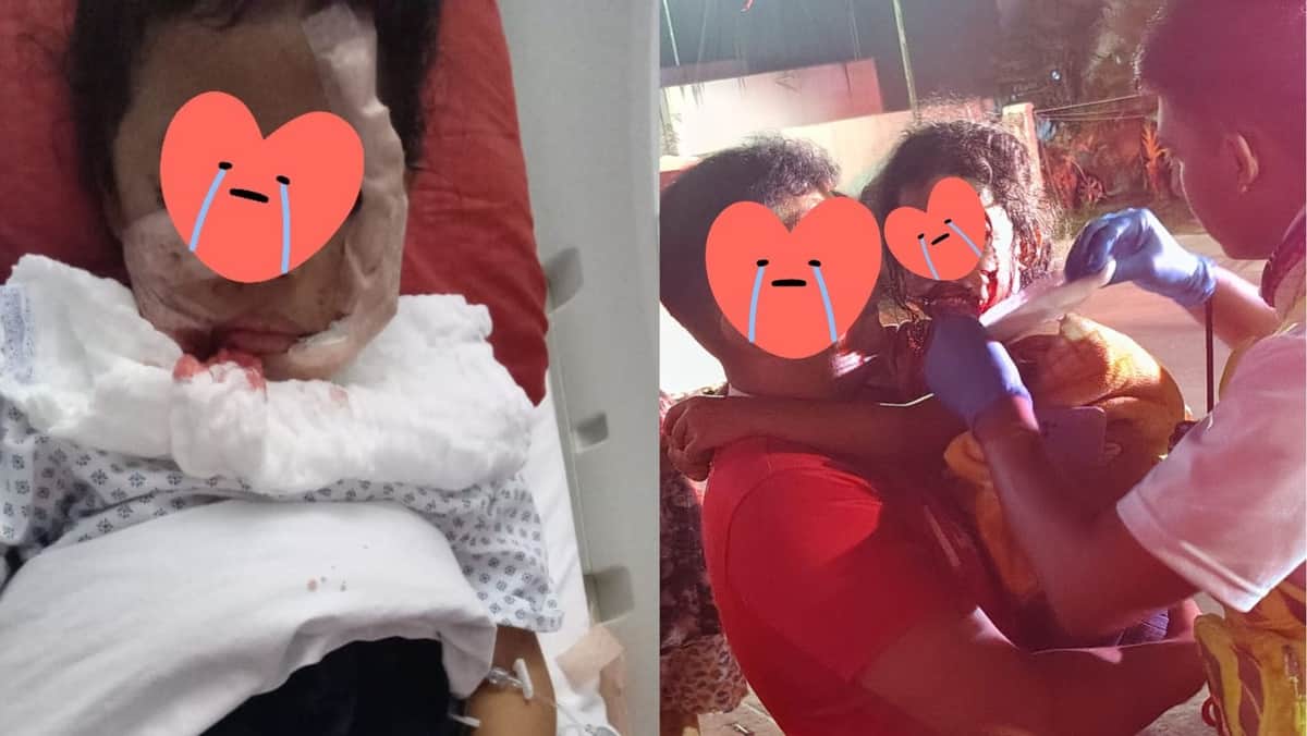 VIDEO: Pitbull ataca a dos hermanitas de Villas del Sol en Playa del Carmen, una requiere cirugía en su rostro