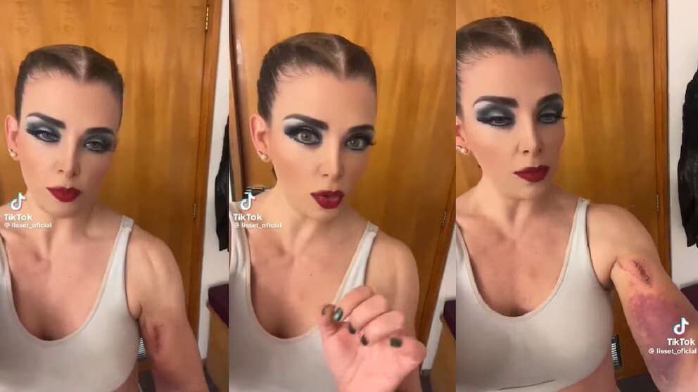 Video: Tras caer en coladera en CDMX, Lisset hace llamado a las autoridades