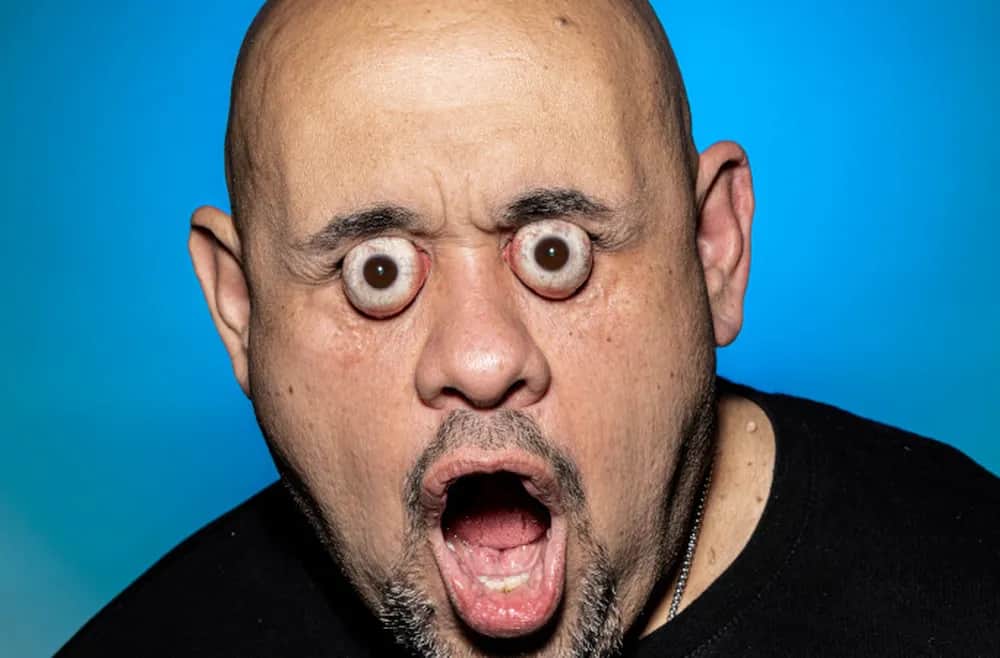 Video: Sujeto de Uruguay logra un insólito Récord Guinness por expandir los ojos de sus órbitas