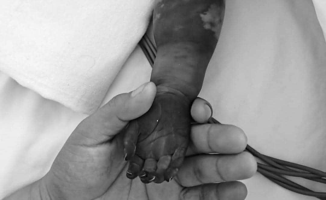 Denuncian presunta negligencia en Hospital General de Cancún; bebé podría perder una mano