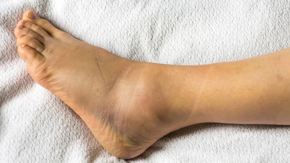 Mujer recibe 11 mdd tras demandar a una tienda donde se torció el tobillo en Florida, Estados Unidos