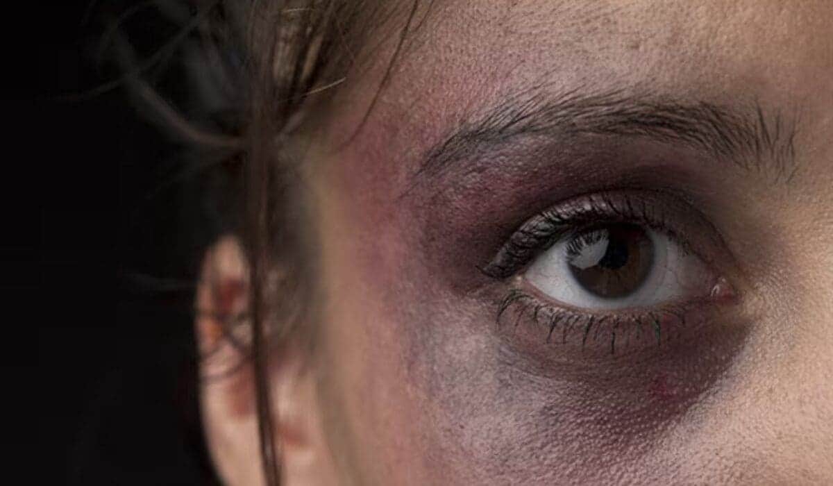 Video: Brutal golpiza entre "amigas" en Edomex deja a la víctima al borde de perder un ojo