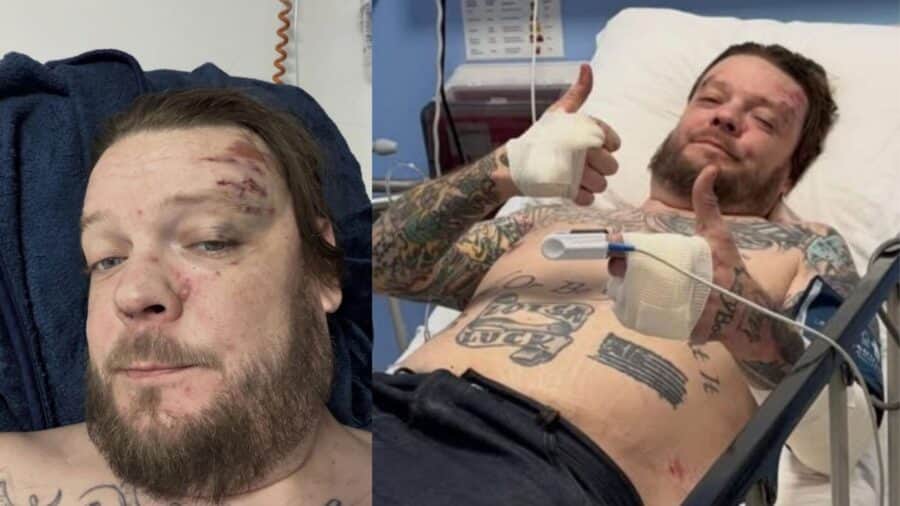 Corey Harrison de "El Precio de la Historia", sufre accidente en motocicleta y se rompe 11 costillas