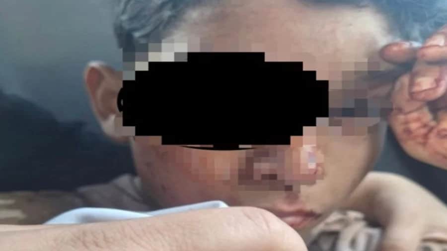 Niño pierde un ojo tras ser golpeado por sujetos en Torreón, Coahuila