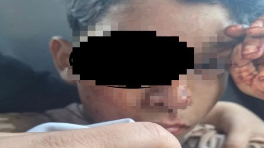 Niño pierde un ojo tras ser golpeado por sujetos en Torreón, Coahuila