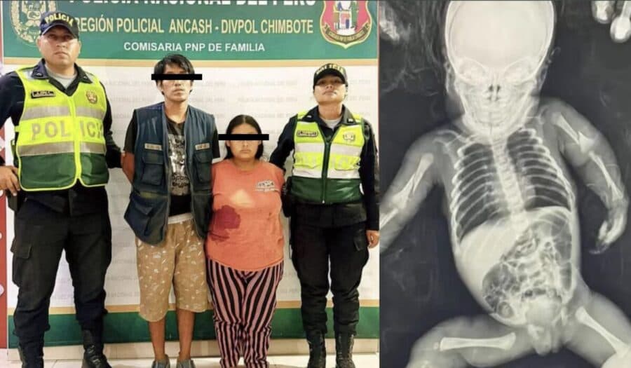 Detienen a pareja por maltratar a su bebé de un mes en Perú