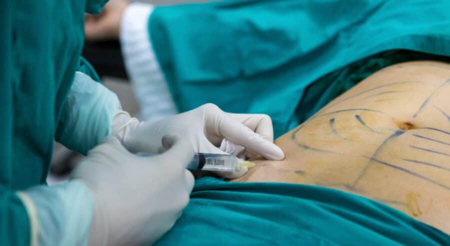 Detienen a presunto cirujano plástico por muerte de paciente tras liposucción en Toluca, Edomex